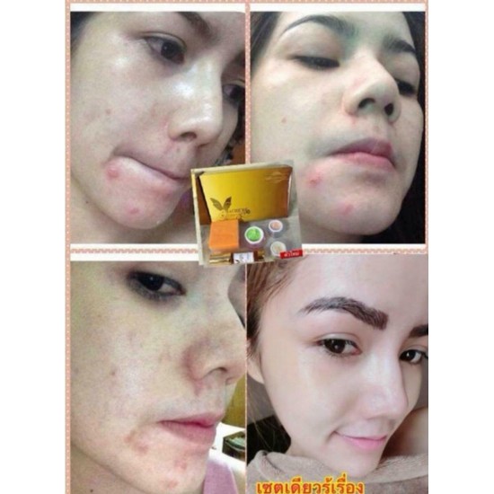 Mache're Gold Whitening Cream Acne freckles wrinkles Natural Premium Big Set