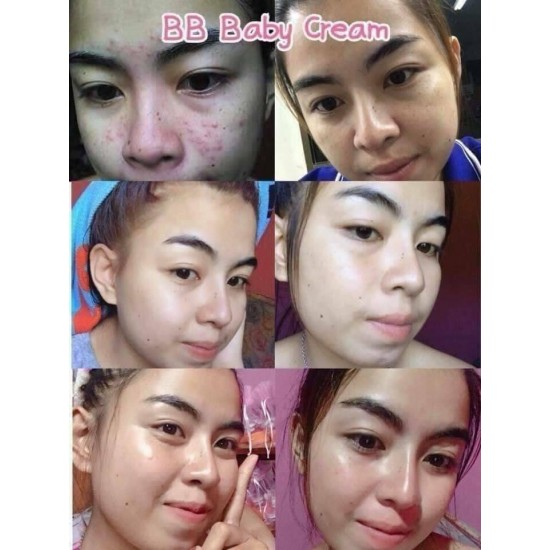 6X BB Cream Baby Dark Spots Freckles Acne Skin Face Set Whitening Reduce Clear