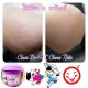 12 X CLEAR DARK BUTT BOTTOM SPOT STRECH MARK REMOVAL WHITENING SOFTEN TREATMENT