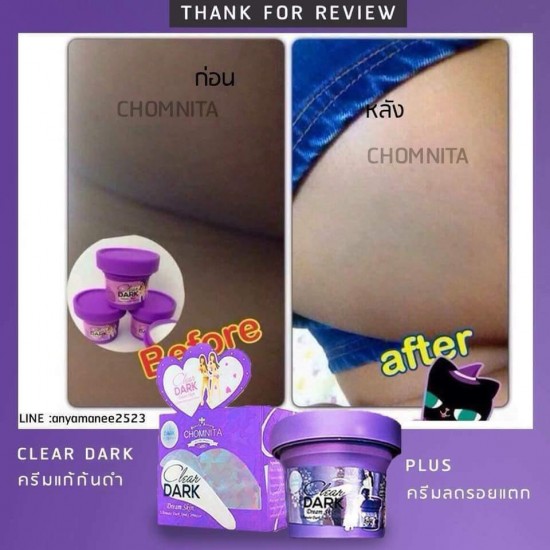 12 X CLEAR DARK BUTT BOTTOM SPOT STRECH MARK REMOVAL WHITENING SOFTEN TREATMENT